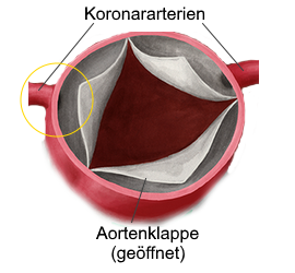 Koronararterien-Schutz durch Aortenklappe